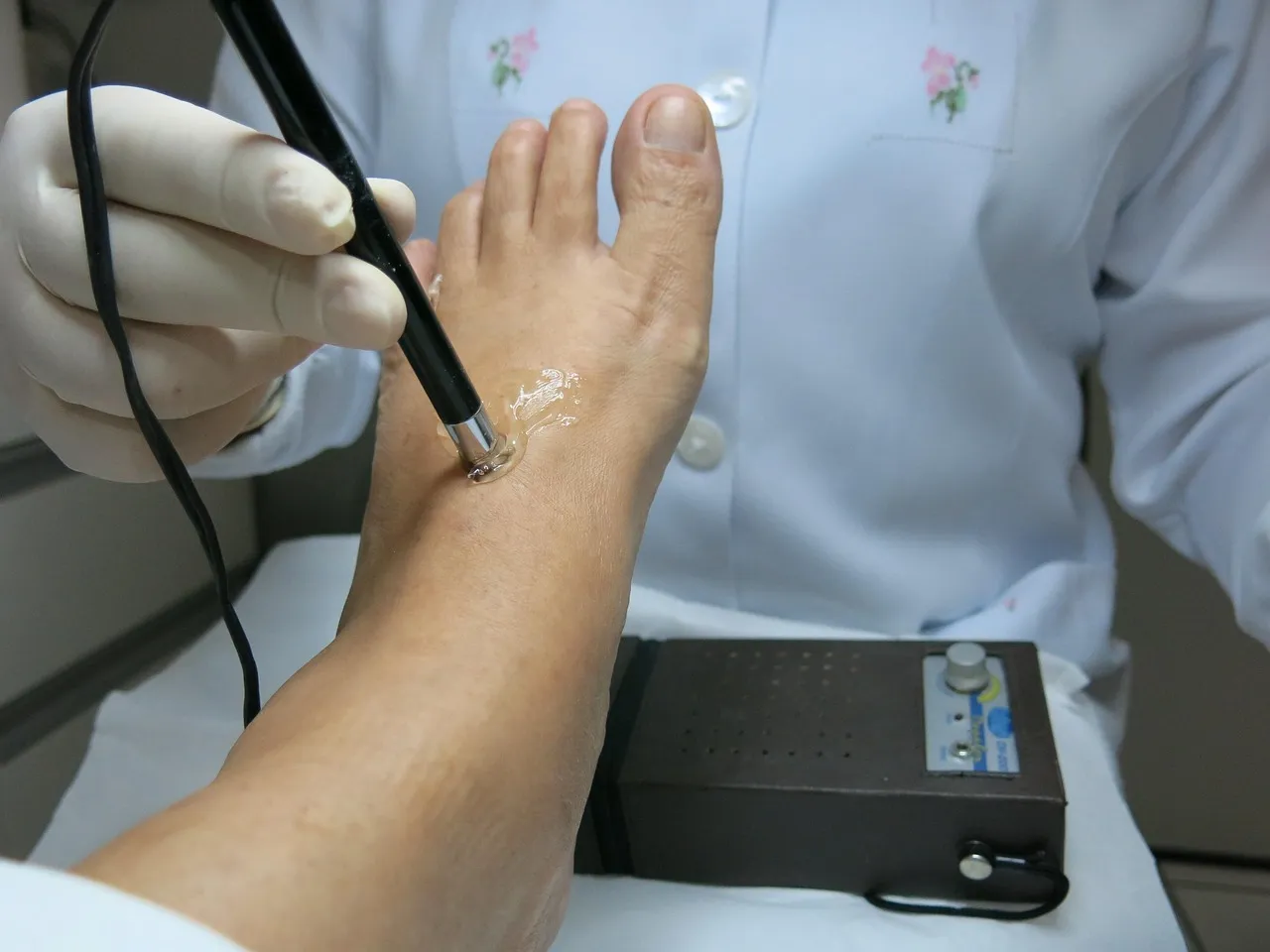 Como tratar la fascitis plantar quía para pacientes en Málaga