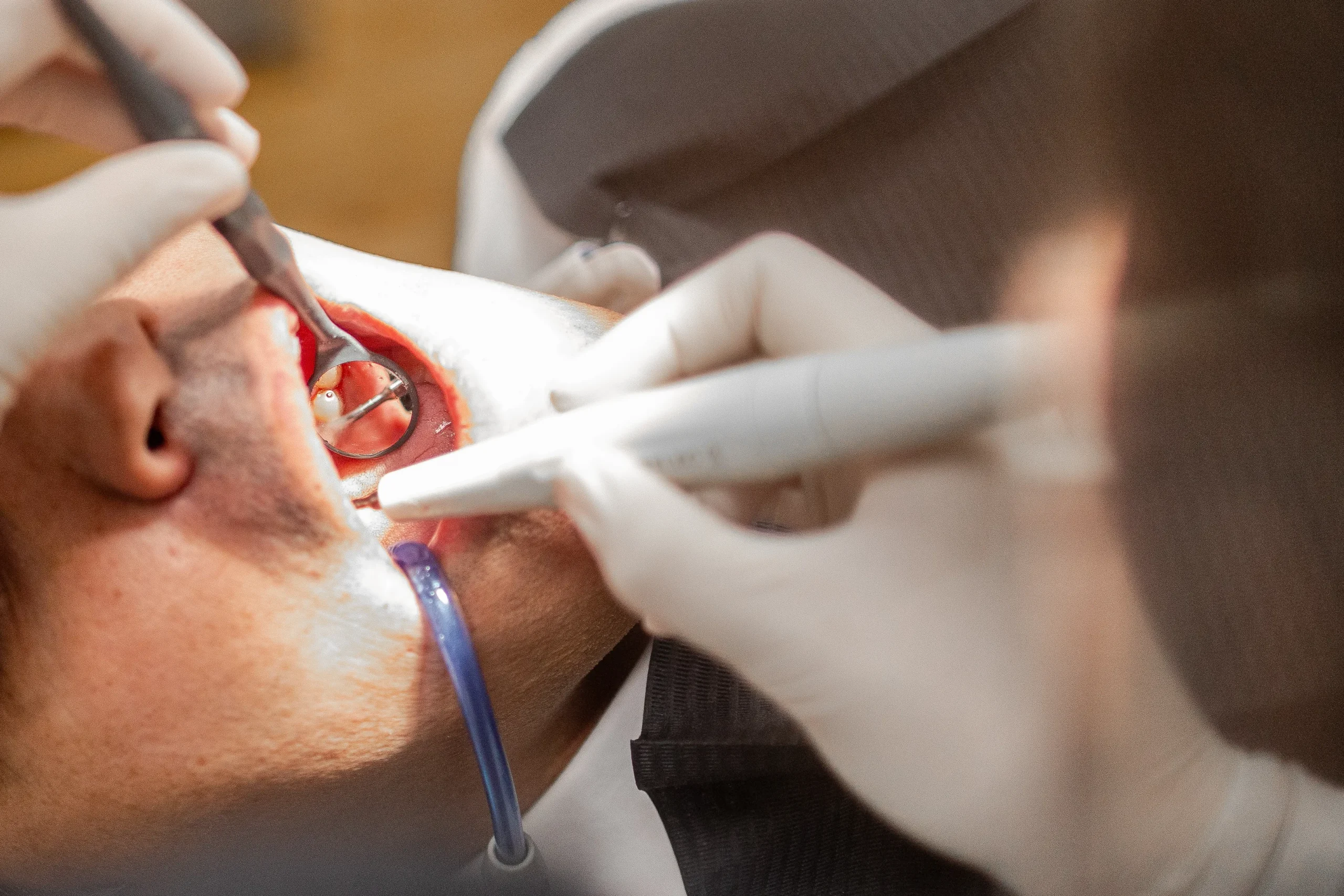 Sensibilidad dental, que lo causa y que tratamientos tenemos