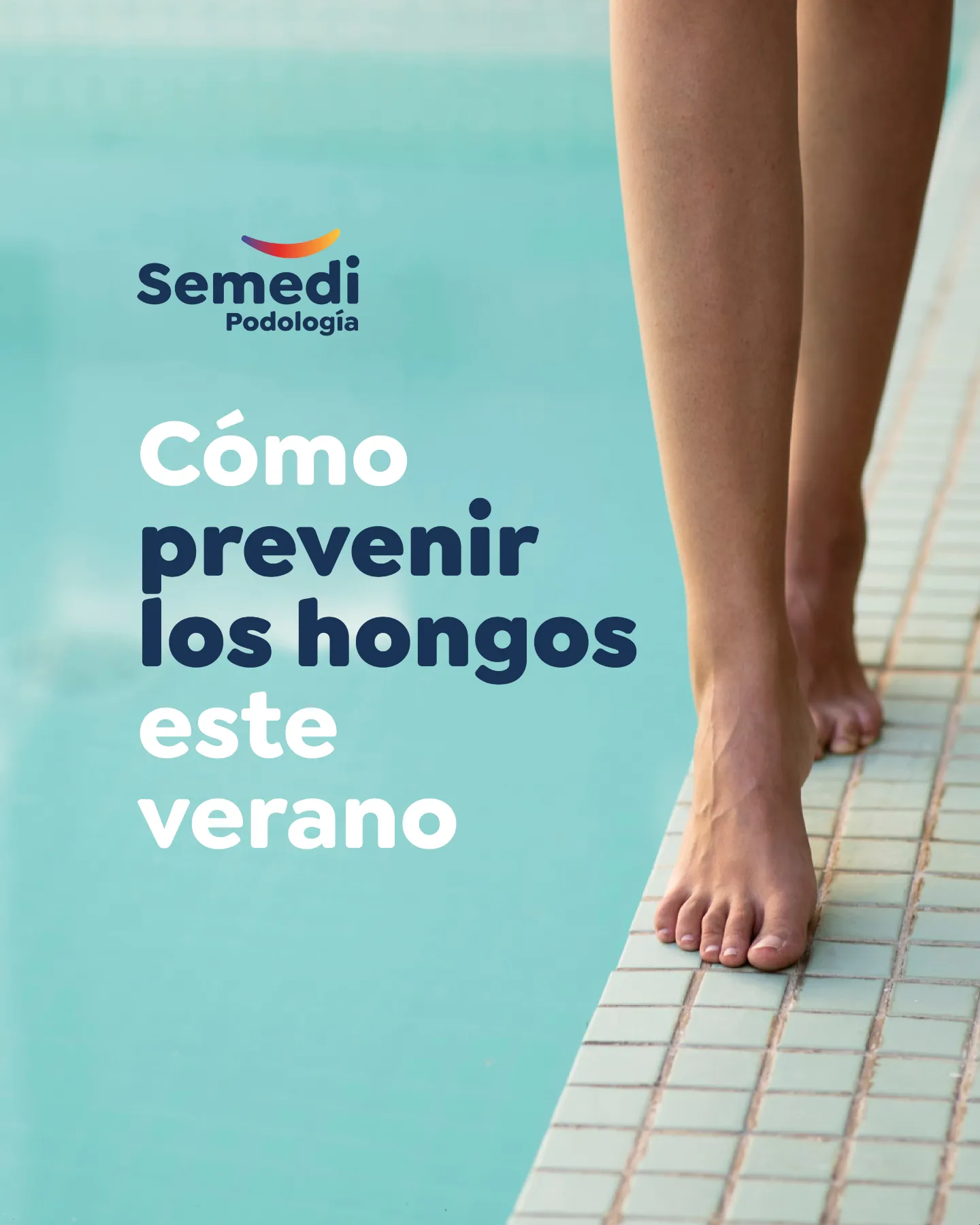 Pies descalzos al borde de una piscina, prevención de hongos en los pies en verano — Semedi Podología Málaga